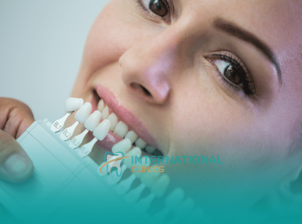ما هو تلبيس الاسنان